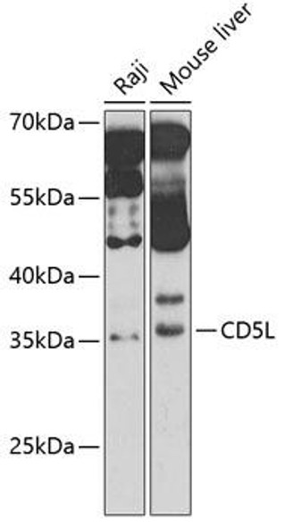 Cell Death Antibodies 2 Anti-CD5L Antibody CAB6223