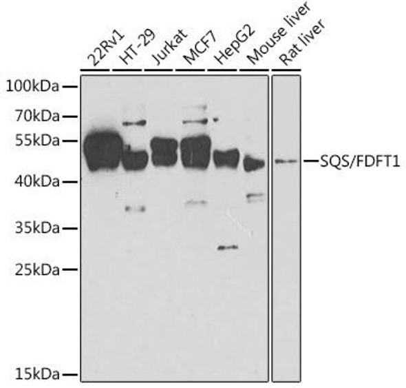 Metabolism Antibodies 2 Anti-SQS/FDFT1 Antibody CAB6229