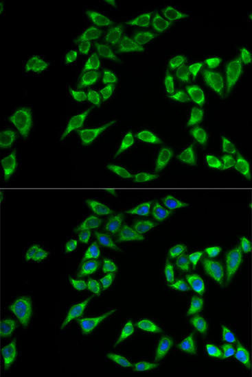 Cell Biology Antibodies 10 Anti-PHLDA2 Antibody CAB6244