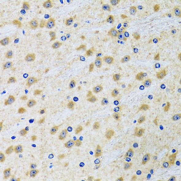 Cell Biology Antibodies 10 Anti-GAB1 Antibody CAB6248