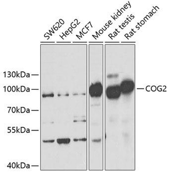 Cell Biology Antibodies 10 Anti-COG2 Antibody CAB6251
