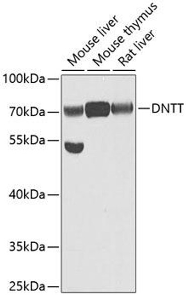 Epigenetics and Nuclear Signaling Antibodies 2 Anti-DNTT Antibody CAB6254