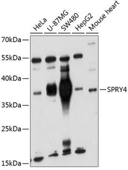 Cell Biology Antibodies 10 Anti-SPRY4 Antibody CAB6263