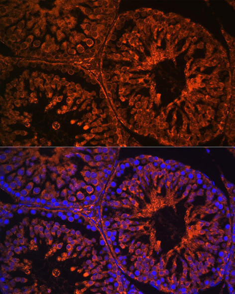 Cell Biology Antibodies 10 Anti-LHCGR Antibody CAB6266