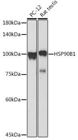 Cell Biology Antibodies 10 Anti-HSP90B1 Antibody CAB6272