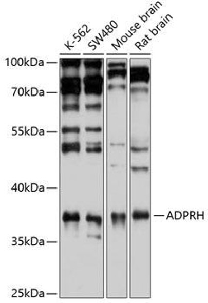 Cell Biology Antibodies 10 Anti-ADPRH Antibody CAB6277