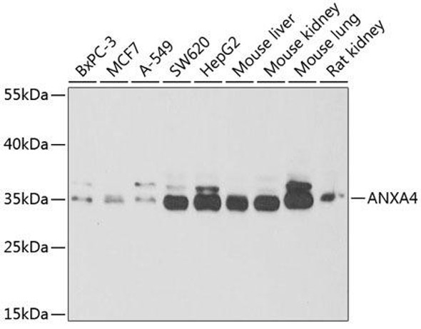 Cell Biology Antibodies 10 Anti-ANXA4 Antibody CAB6280