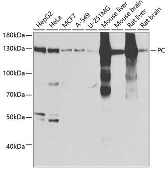 Metabolism Antibodies 2 Anti-PC Antibody CAB6301