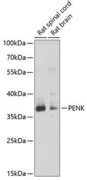 Cell Biology Antibodies 10 Anti-PENK Antibody CAB6302