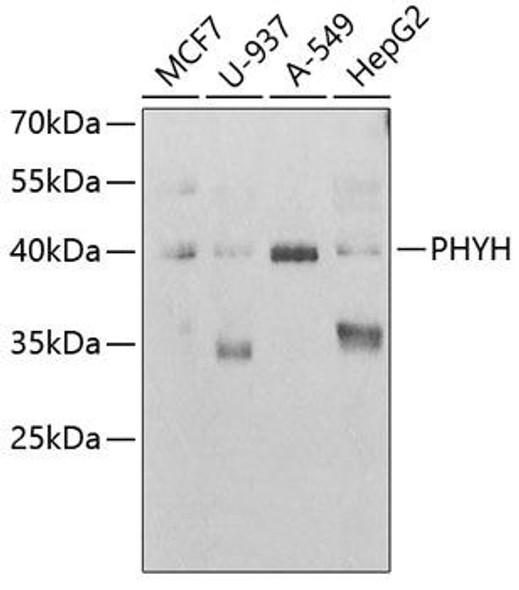 Cell Biology Antibodies 10 Anti-PHYH Antibody CAB6304