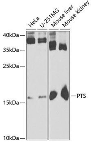 Metabolism Antibodies 2 Anti-PTS Antibody CAB6306