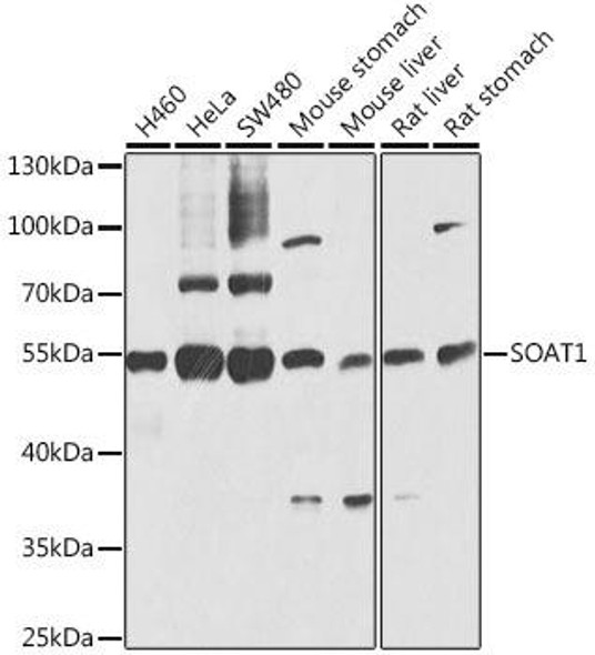 Metabolism Antibodies 2 Anti-SOAT1 Antibody CAB6311