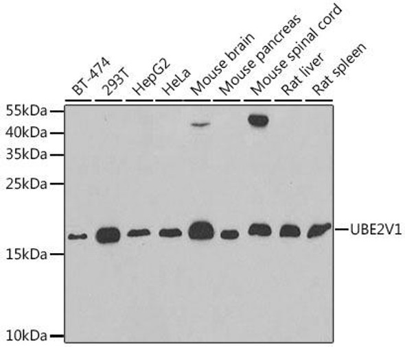Signal Transduction Antibodies 3 Anti-UBE2V1 Antibody CAB6316