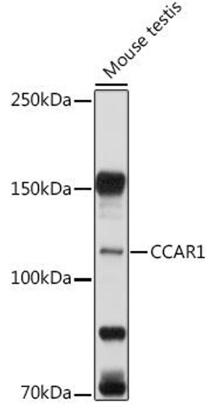Cell Death Antibodies 2 Anti-CCAR1 Antibody CAB6334