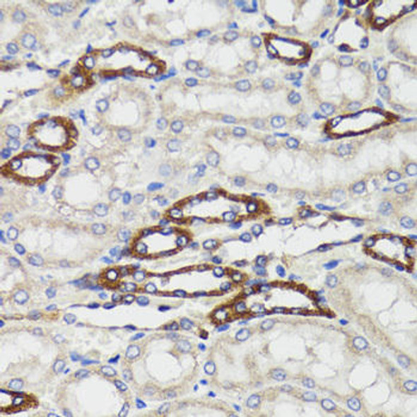 Cell Death Antibodies 2 Anti-BCAP29 Antibody CAB6335