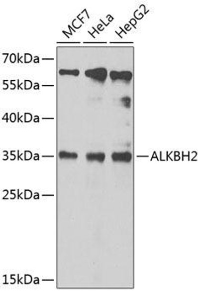 Epigenetics and Nuclear Signaling Antibodies 4 Anti-ALKBH2 Antibody CAB6340