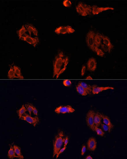 Cardiovascular Antibodies Anti-FAP Antibody CAB6349