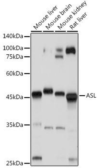 Metabolism Antibodies 2 Anti-ASL Antibody CAB6357