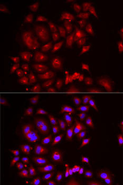 Signal Transduction Antibodies 3 Anti-SLC26A2 Antibody CAB6369