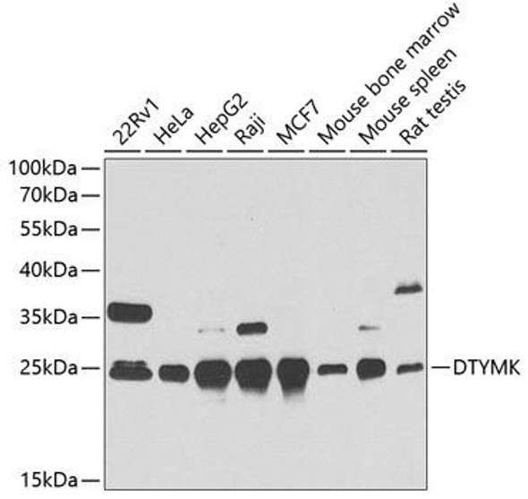 Epigenetics and Nuclear Signaling Antibodies 4 Anti-DTYMK Antibody CAB6370