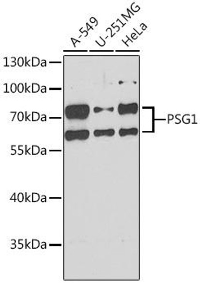 Cell Biology Antibodies 10 Anti-PSG1 Antibody CAB6399