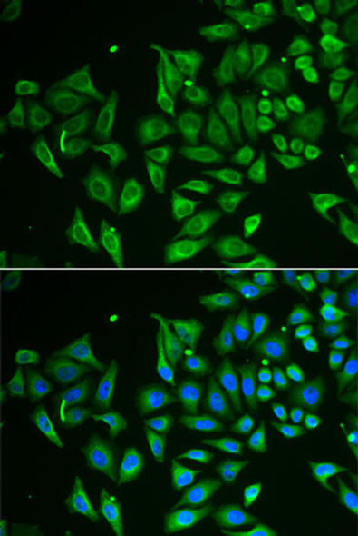 Cell Biology Antibodies 10 Anti-CLEC3B Antibody CAB6418