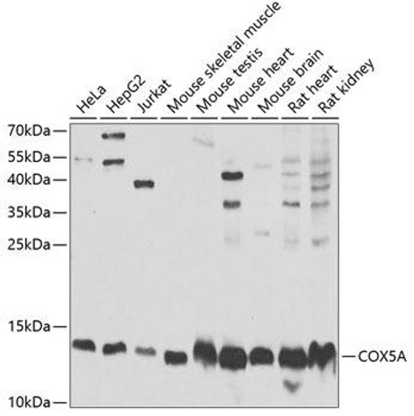 Cell Biology Antibodies 10 Anti-COX5A Antibody CAB6437