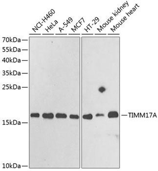 Cell Biology Antibodies 10 Anti-TIMM17A Antibody CAB6449