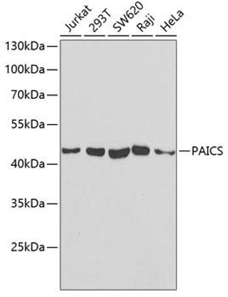 Metabolism Antibodies 2 Anti-PAICS Antibody CAB6450