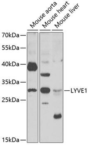 Signal Transduction Antibodies 3 Anti-LYVE1 Antibody CAB6452