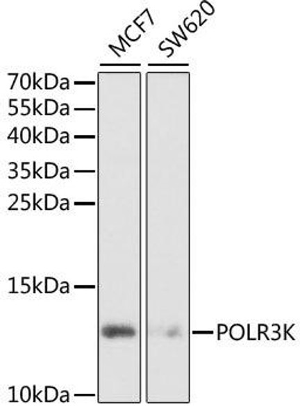 Immunology Antibodies 2 Anti-POLR3K Antibody CAB6467