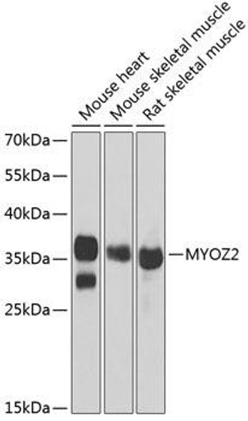 Cell Biology Antibodies 10 Anti-MYOZ2 Antibody CAB6468
