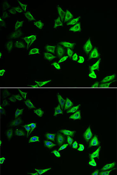 Cell Biology Antibodies 10 Anti-MYOZ2 Antibody CAB6468