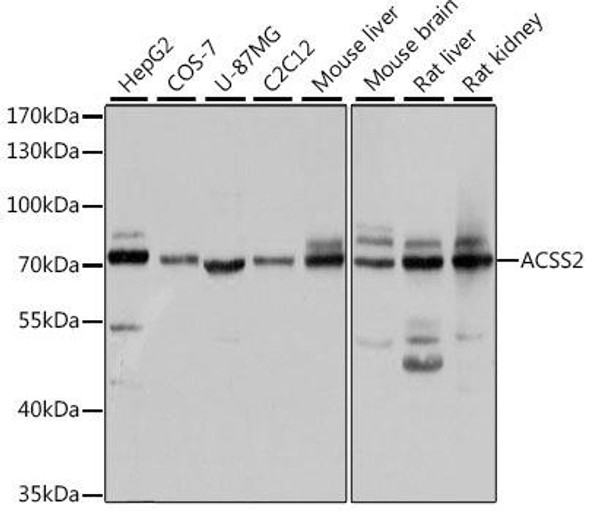 Cell Biology Antibodies 10 Anti-ACSS2 Antibody CAB6472