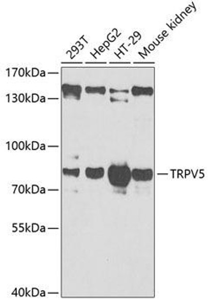 Cell Biology Antibodies 10 Anti-TRPV5 Antibody CAB6473