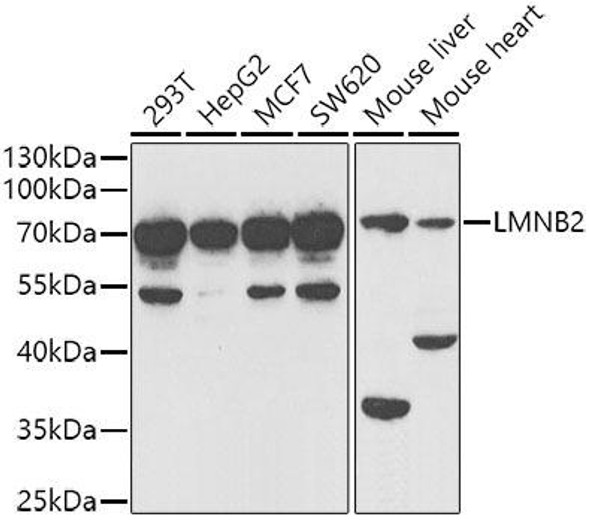 Cell Biology Antibodies 10 Anti-LMNB2 Antibody CAB6483