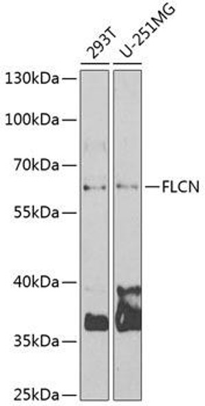 Cell Biology Antibodies 10 Anti-FLCN Antibody CAB6493