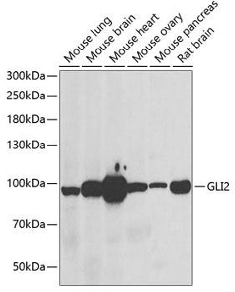 Cell Biology Antibodies 16 Anti-GLI2 Antibody CAB6510