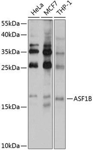 Developmental Biology Anti-ASF1B Antibody CAB6511