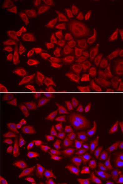 Metabolism Antibodies 2 Anti-AGPAT2 Antibody CAB6518