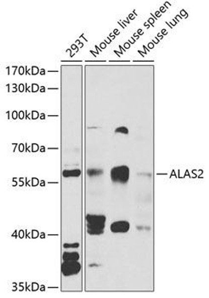 ChIP Antibodies Anti-ALAS2 Antibody CAB6522