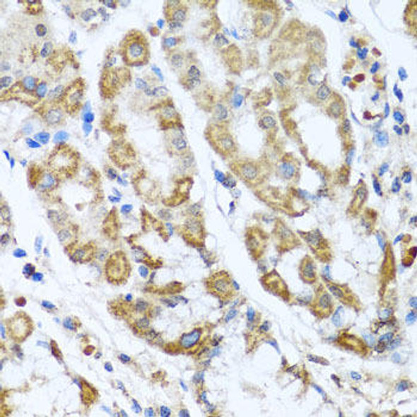 Cell Biology Antibodies 10 Anti-ANTXR2 Antibody CAB6526