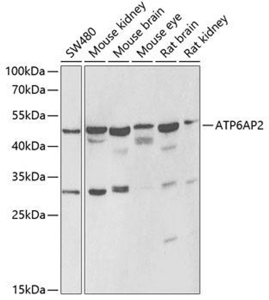 Cell Biology Antibodies 10 Anti-ATP6AP2 Antibody CAB6531
