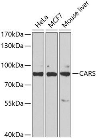 Metabolism Antibodies 2 Anti-CARS Antibody CAB6540