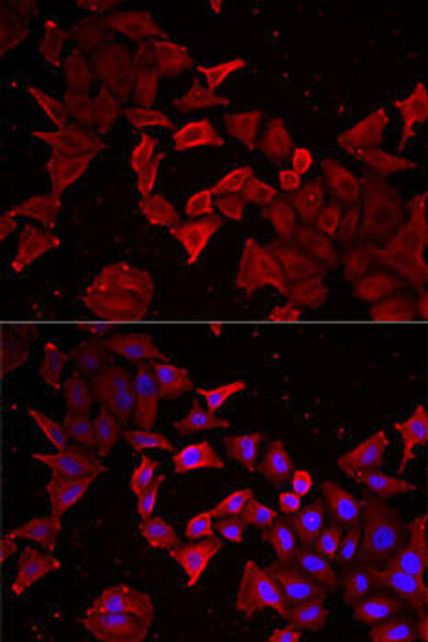 Developmental Biology Anti-Caspase-14 Antibody CAB6541