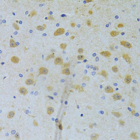 Cell Death Antibodies 2 Anti-CHIA Antibody CAB6558