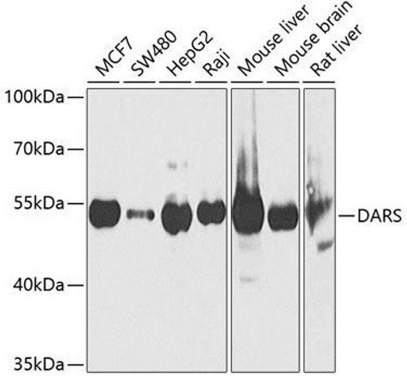 Metabolism Antibodies 2 Anti-DARS Antibody CAB6574