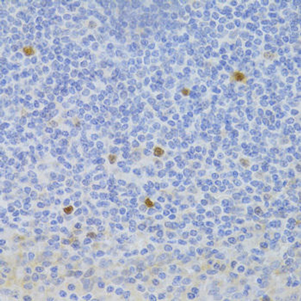 Immunology Antibodies 2 Anti-FCN1 Antibody CAB6587