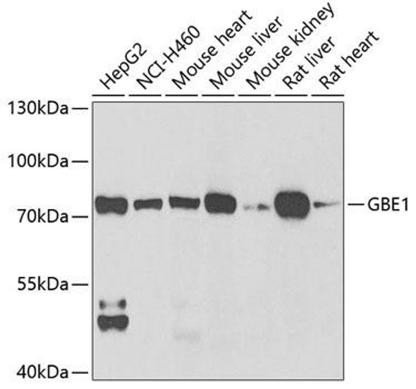 Metabolism Antibodies 2 Anti-GBE1 Antibody CAB6599