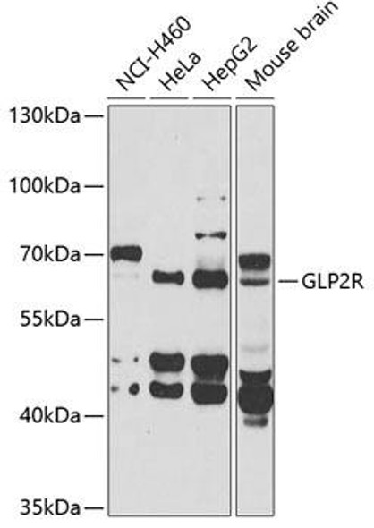 Cell Biology Antibodies 10 Anti-GLP2R Antibody CAB6602